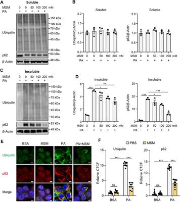 Methylsulfonylmethane ameliorates metabolic-associated fatty liver disease by restoring autophagy flux via AMPK/mTOR/ULK1 signaling pathway